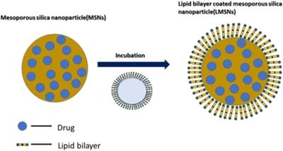 Lipid-based oral formulation in capsules to improve the delivery of poorly water-soluble drugs